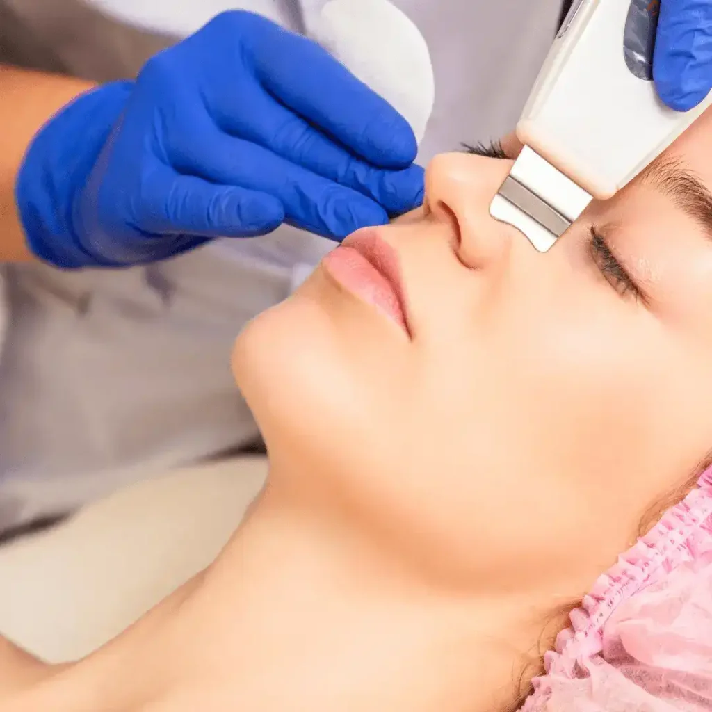 Peeling cavitational exemplu